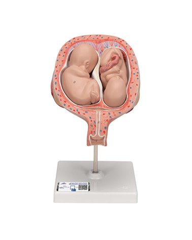 Μοντέλο Δίδυμων Εμβρύων, 5ος Μήνας σε Κανονική Θέση