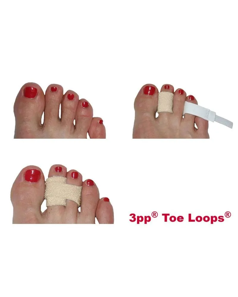 Νάρθηκας Δακτύλου Toe Loop